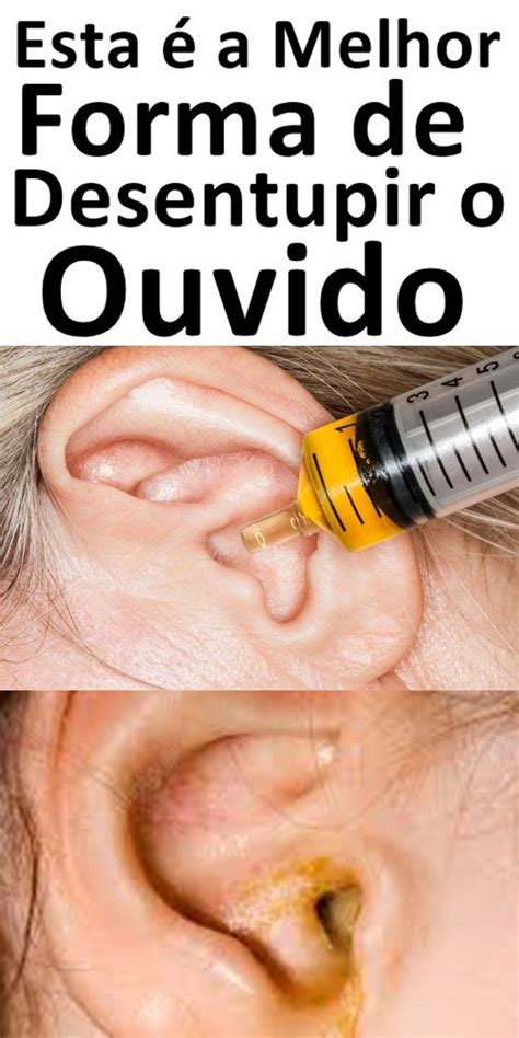 remedio para dor no ouvido-1